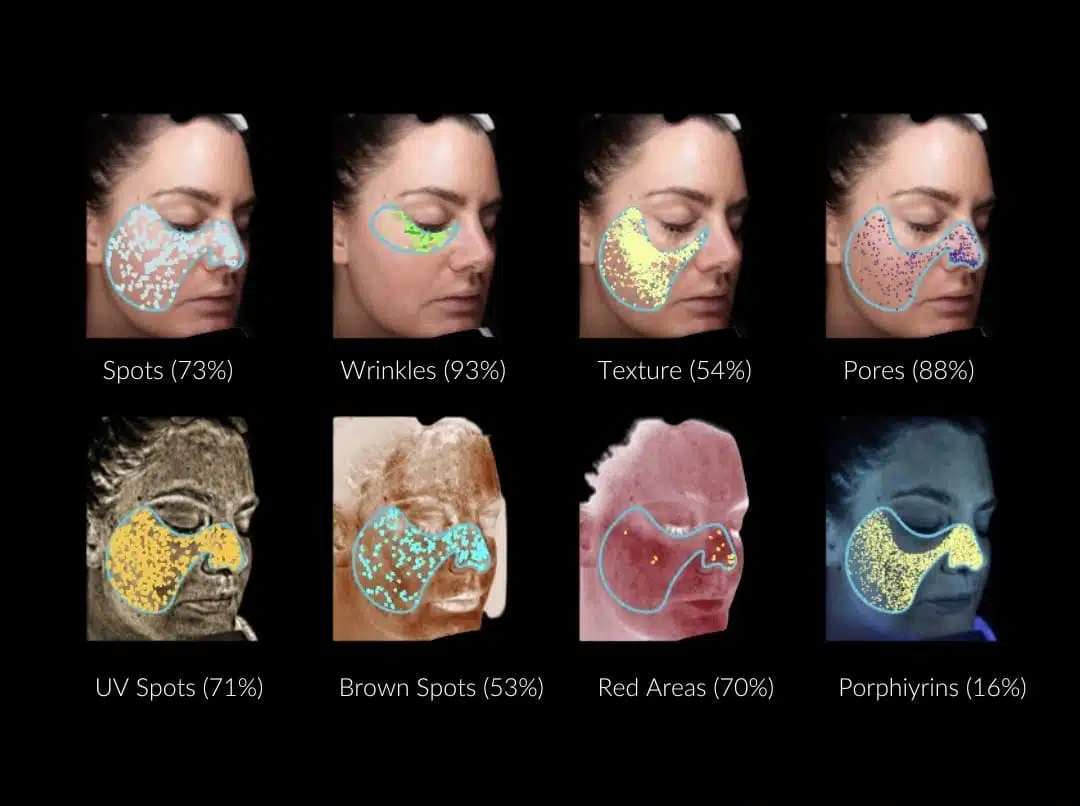 Diamondglow Facial Beverly Hills