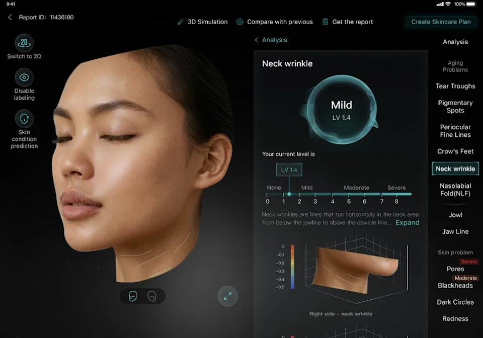 AI-powered EveLab skin analysis before a facial at SKIN/tervention Beverly Hills