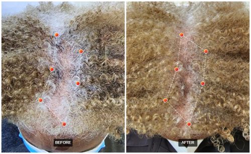 REVIAN Red Light Therapy before and after results with Dr. Zoë Indigo