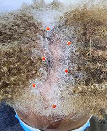 REVIAN Red Light Therapy Before & After