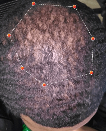 REVIAN Red Light Therapy Before & After